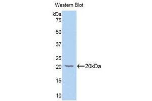 Western Blotting (WB) image for anti-Galactosylceramidase (GALC) (AA 375-535) antibody (ABIN1176550)