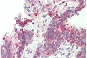 Human, Lung: Formalin-Fixed Paraffin-Embedded (FFPE) (Glucose-6-Phosphate Dehydrogenase Antikörper  (AA 180-229))