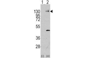 Western blot analysis of PDGFR antibody and 293 cell lysate (2 ug/lane) either nontransfected (Lane 1) or transiently transfected with the PDGFRA gene (2).