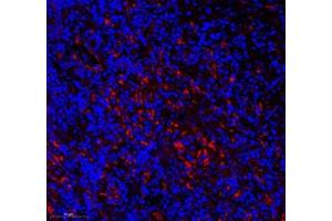 Immunofluorescence of paraffin embedded mouse thymus using CD163b (ABIN7073371) at dilution of 1: 700 (300x lens) (CD163L1 Antikörper)