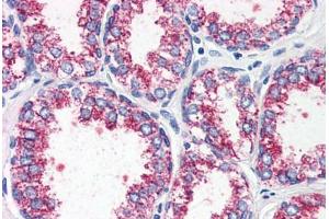 Prostate, Human: Formalin-Fixed, Paraffin-Embedded (FFPE) (CCKAR Antikörper  (Internal Region))