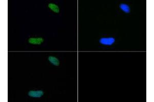 Fluorescence Microscopy (FM) image for anti-Histone H4 (2meLys20) antibody (ABIN5706798)