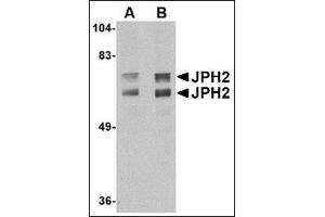 Western blot analysis of JPH2 in mouse brain tissue lysate with JPH2 antibody at (A) 1 and (B) 2 µg/ml
