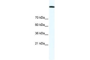 TOP2A antibody (20R-1304) used at 1. (Topoisomerase II alpha Antikörper  (C-Term))