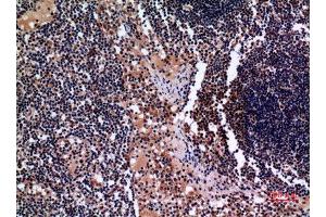 Immunohistochemistry (IHC) analysis of paraffin-embedded Human Lymph Gland, antibody was diluted at 1:100. (Cytokeratin 19 Antikörper  (C-Term))