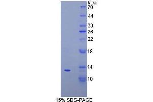 SDS-PAGE analysis of Cow IP10 Protein.