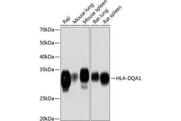 HLA-DQA1 Antikörper