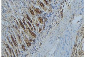 ABIN6277333 at 1/100 staining Human gastric tissue by IHC-P. (IMMT Antikörper  (Internal Region))