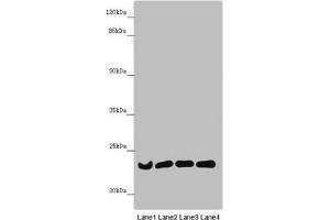 Western blot All lanes: B9D1 antibody at 6. (B9D1 Antikörper  (AA 1-130))