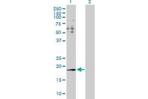 Western Blot analysis of HYI expression in transfected 293T cell line by HYI MaxPab polyclonal antibody.