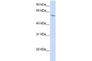 WB Suggested Anti-PORCN Antibody Titration:  0. (PORCN Antikörper  (N-Term))