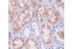 Immunohistochemistry (IHC) image for anti-Ancient Ubiquitous Protein 1 (Aup1) (AA 201-410) antibody (ABIN5013124)