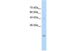 WB Suggested Anti-HIP2 Antibody Titration:  5.