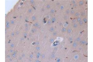 Detection of LCNL1 in Rat Cerebrum Tissue using Polyclonal Antibody to Lipocalin Like Protein 1 (LCNL1) (LCNL1 Antikörper)