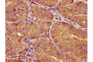 Immunohistochemistry (IHC) image for anti-Casein Kinase 1, epsilon (CSNK1E) (AA 17-231), (Isoform epsilon) antibody (ABIN7146866)