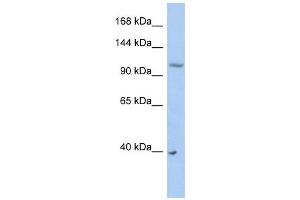 NEDD4L antibody used at 1 ug/ml to detect target protein. (NEDD4-2 Antikörper  (Middle Region))