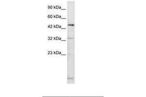 Image no. 1 for anti-DMRT-Like Family A2 (DMRTA2) (AA 247-296) antibody (ABIN6735877) (DMRTA2 Antikörper  (AA 247-296))