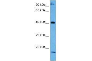 Host:  Rabbit  Target Name:  NFKBIB  Sample Tissue:  Mouse Testis  Antibody Dilution:  1ug/ml (NFKBIB Antikörper  (Middle Region))
