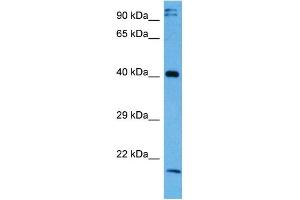 Host:  Rabbit  Target Name:  NFKBIB  Sample Tissue:  Mouse Testis  Antibody Dilution:  1ug/ml