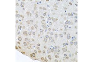 Immunohistochemistry of paraffin-embedded mouse brain using PABPC4 antibody (ABIN5973544) at dilution of 1/100 (40x lens). (PABPC4 Antikörper)