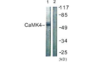 Immunohistochemistry analysis of paraffin-embedded human brain tissue using CaMK4 (Ab-196/200) antibody. (CAMK4 Antikörper  (Thr196))