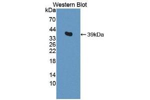 Western blot analysis of the recombinant protein. (SPARC Antikörper  (AA 18-302))