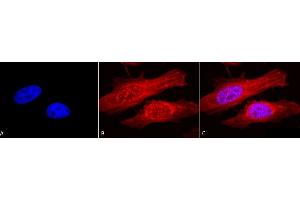 Immunocytochemistry/Immunofluorescence analysis using Rabbit Anti-Alpha B Crystallin Polyclonal Antibody (ABIN361836 and ABIN361837). (CRYAB Antikörper)