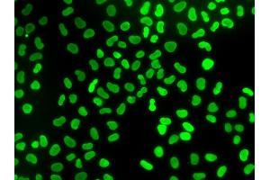 Immunofluorescence analysis of U2OS cells using TMPO antibody.