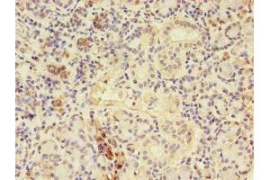 Immunohistochemistry of paraffin-embedded human pancreatic tissue using ABIN7148714 at dilution of 1:100 (CTP Synthase Antikörper  (AA 300-554))