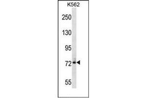 Western Blotting (WB) image for anti-Dynein, Axonemal, Intermediate Chain 1 (DNAI1) (AA 91-120), (N-Term) antibody (ABIN951938)