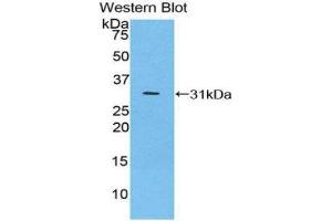 Western Blotting (WB) image for anti-Inhibitory Subunit of NF-KappaB zeta (AA 414-654) antibody (ABIN1859324) (Inhibitory Subunit of NF-KappaB zeta (AA 414-654) Antikörper)