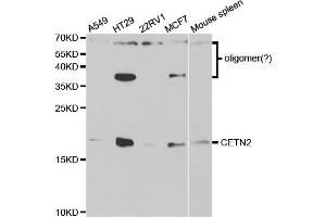 Western Blotting (WB) image for anti-Centrin, EF-Hand Protein, 2 (CETN2) antibody (ABIN1876585) (CETN2 Antikörper)