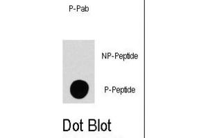 Dot Blot (DB) image for anti-Mitogen-Activated Protein Kinase Kinase Kinase Kinase 4 (MAP4K4) (pSer801) antibody (ABIN3001825) (MAP4K4 Antikörper  (pSer801))