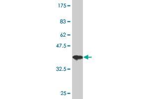 Western Blot detection against Immunogen (37. (HDAC3 Antikörper  (AA 319-428))