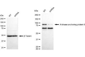 Western blotting analysis using A-kinase anchoring protein 8 antibody (ABIN7797434).
