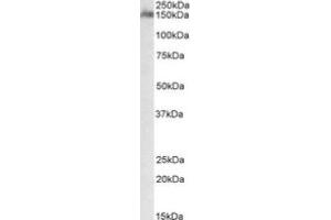 Image no. 1 for anti-CUB and Sushi Multiple Domains 1 (CSMD1) (Internal Region) antibody (ABIN487986) (CSMD1 Antikörper  (Internal Region))