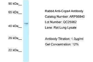 Western Blotting (WB) image for anti-COP9 Signalosome Subunit 4 (COPS4) (N-Term) antibody (ABIN970429) (COPS4 Antikörper  (N-Term))