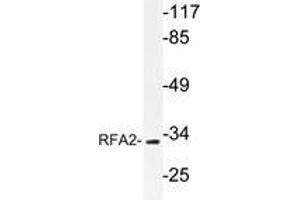 Western blot analysis of RFA2 antibody in extracts from HepG2 cells. (RPA2 Antikörper  (AA 115-129))