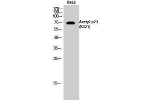 Tumor Protein p73 Antikörper  (acLys321)