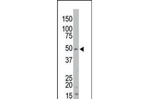 Antibody is used in Western blot to detect STK35 in mouse kidney tissue lysate. (STK35 Antikörper  (AA 374-404))