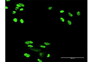 Immunofluorescence of purified MaxPab antibody to XRCC6 on HeLa cell. (XRCC6 Antikörper  (AA 1-609))
