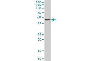 Western Blotting (WB) image for anti-Transcriptional Adaptor 2B (TADA2B) (AA 2-111) antibody (ABIN466261) (TADA2B Antikörper  (AA 2-111))