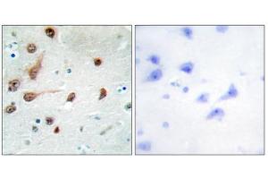 Immunohistochemistry analysis of paraffin-embedded human brain tissue, using ADAR1 antibody. (ADAR Antikörper  (C-Term))