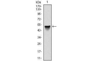 Western blot analysis using SRC mAb against human SRC (AA: 1-189) recombinant protein. (Src Antikörper)