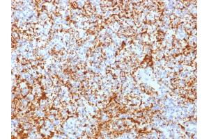 Formalin-fixed, paraffin-embedded human Spleen stained with CD61 Rabbit Recombinant Monoclonal Antibody (ITGB3/2166R). (Rekombinanter Integrin beta 3 Antikörper  (AA 385-490))