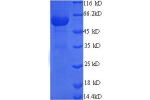 SDS-PAGE (SDS) image for Monoamine Oxidase B (MAOB) (AA 2-489), (Cytoplasmic Domain), (Cytosolic) protein (His tag) (ABIN5709893)