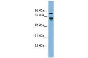 Image no. 1 for anti-ATP-Binding Cassette, Sub-Family F (GCN20), Member 2 (ABCF2) (AA 143-192) antibody (ABIN6741721) (ABCF2 Antikörper  (AA 143-192))
