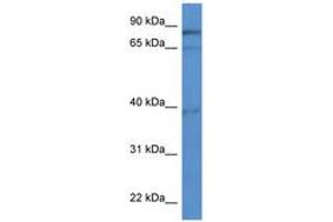 Image no. 1 for anti-Zinc Finger, CCHC Domain Containing 7 (ZCCHC7) (AA 453-502) antibody (ABIN6746848) (ZCCHC7 Antikörper  (AA 453-502))
