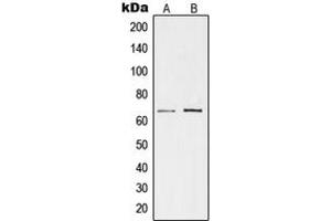Western blot analysis of TESK1 expression in K562 (A), rat kidney (B) whole cell lysates. (TESK1 Antikörper  (Center))