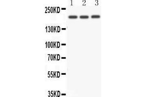 Anti- NOTCH4 antibody, Western blotting All lanes: Anti NOTCH4  at 0.